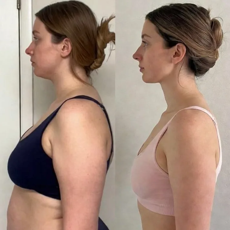 Antes e depois — resultado real