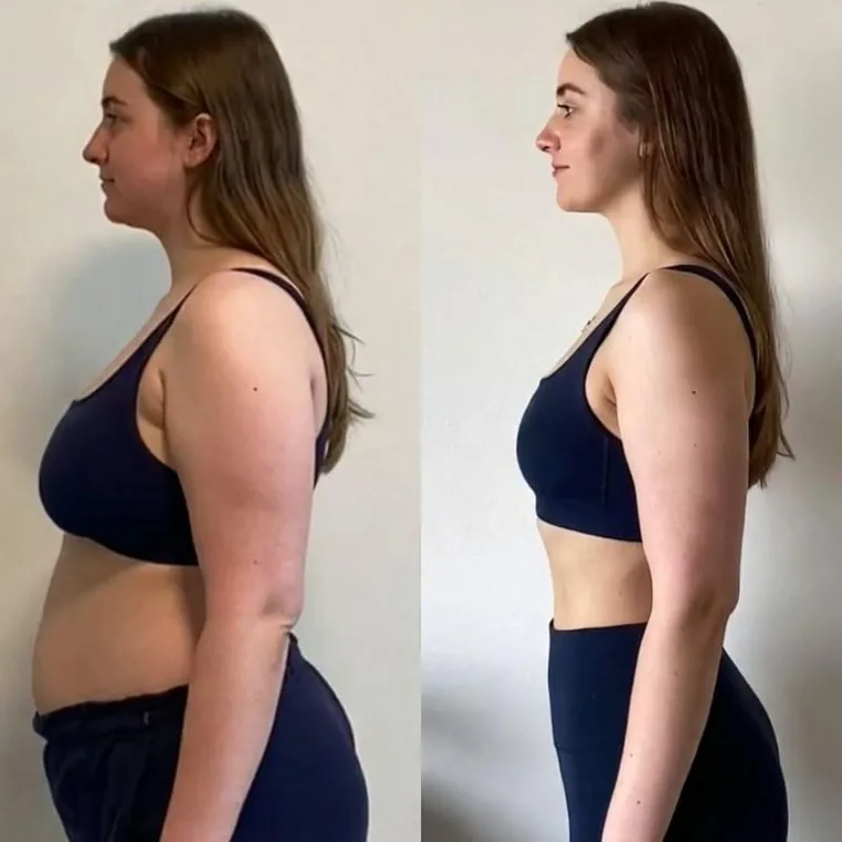 Antes e depois — resultado real