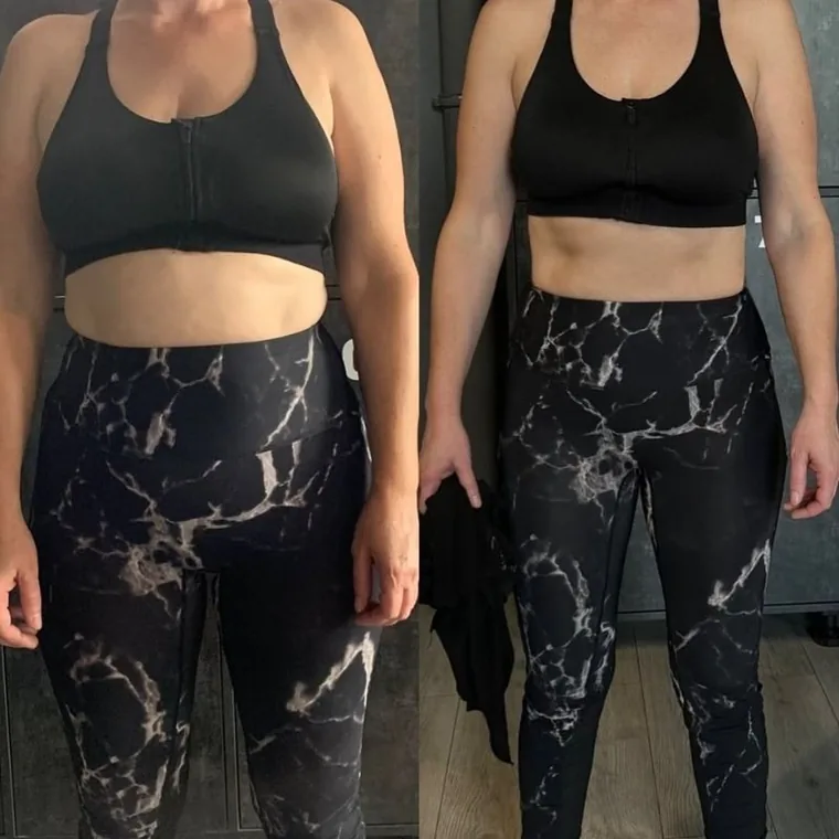 Antes e depois — resultado real