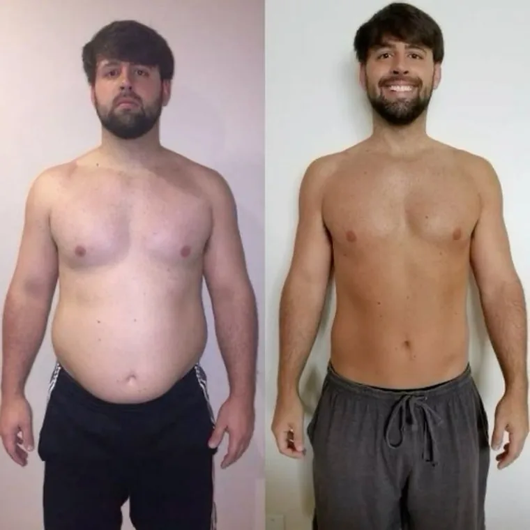Antes e depois — resultado real