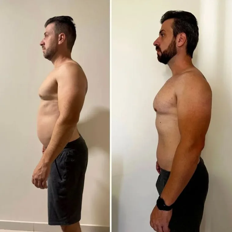 Antes e depois — resultado real