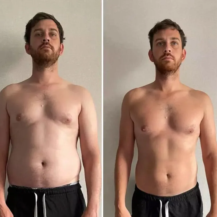 Antes e depois — resultado real